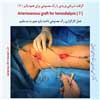 رگ مصنوعی بازو 7