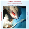 کارگزاری کاتتر دائم 28