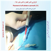 کارگزاری کاتتر دائم 25
