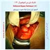 بای پس ایلیوفمورال 13