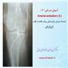 آمبولی شریانی 6