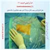 اندآرترکتومی کاروتید 2