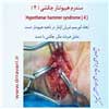 سندرم هیپوتنار 4