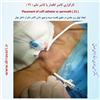 کارگزاری کاتتر دائم 21