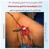 رگ مصنوعی بازو 15