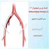 بای پس ایلیوفمورال 3