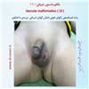 مالفورماسیون عروقی 10