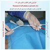 کارگزاری کاتتر دائم 16