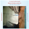 کارگزاری کاتتر دائم 11