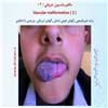 مالفورماسیون عروقی 2