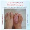 پای دیابتی عفونت 3