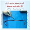 آماده سازی ورید صافن 3
