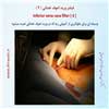فیلتر ورید کاو 4