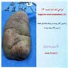 جراحی لنف ادم شدید 14