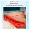 صدمه شریان پوپلیته 8