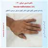مالفورماسیون عروقی 14