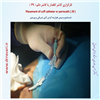 کارگزاری کاتتر دائم 29
