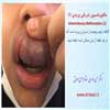 مالفورماسیون شریانی وریدی 1