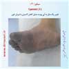 سیانوز 3