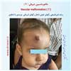 مالفورماسیون عروقی 7