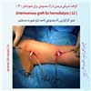 رگ مصنوعی بازو 12