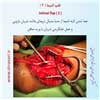 فلپ انتیما 2