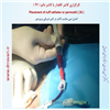 کارگزاری کاتتر دائم 26