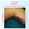 اکیموز 3