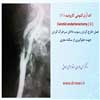 اندآرترکتومی کاروتید 1