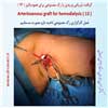 رگ مصنوعی بازو 13