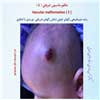 مالفورماسیون عروقی 5