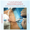 کارگزاری کاتتر دائم 20