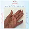 سیانوز 2