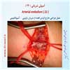 آمبولی شریانی 22