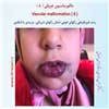 مالفورماسیون عروقی 8