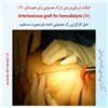 رگ مصنوعی بازو 9