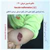 مالفورماسیون عروقی 12