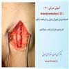 آمبولی شریانی 17