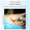 عمل واریس 10